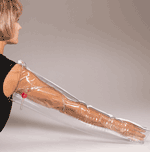 Full arm air splint