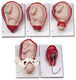 Childbirth Model