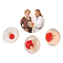 Life in the Womb&trade; Prenatal Education Set