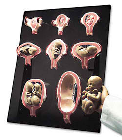 Intrauterine Human Development Models and Fetal Ultrasounds CD-ROM